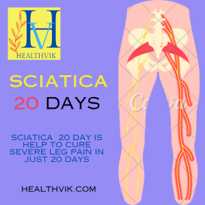 Sciatica 20 days